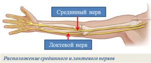 Синдром переднего межкостного нерва