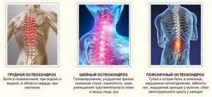 Заболевания грудного отдела позвоночника: причины, лечение, симптомы, признаки